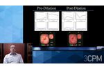 3CPM - Lecture: Gastroparesis - Predicting and Curing Disease - Video