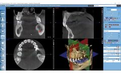 Examining 3D images in Planmeca Romexis - Video