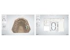 3Shape Dental System™ CAD Software