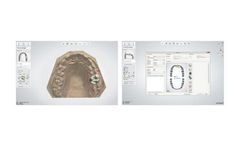 3Shape Dental System™ CAD Software