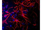 GFAP - Anti-Glial Fibrillary Acidic Protein Antibody