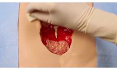 Prepare the Wound - Video
