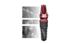 Genesis - Biomimetic Implant System