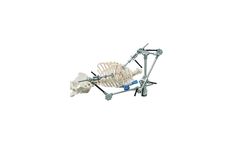 marTract - Model MIDCAB - Rib Retractor System