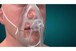 OxyMask ETCO2 Technology - Video