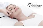 Pristine???: Viora`s Diamond Tipped Microdermabrasion - Video