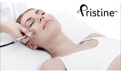 Pristine???: Viora`s Diamond Tipped Microdermabrasion - Video