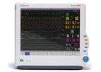 Penlon AnaVue - Model 4000 - Patient Monitor
