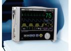 IRadimed - Model 3880 - MRI Patient Monitoring System