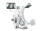 Orthoscan - Model Ziehm Solo FD - Compact C-arms