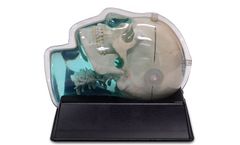 CIRS - Model MR -603-GS - Distortion & Image Fusion Head Phantom