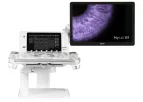 MyLab - Model X9 - Opening Infinite Horizons Ultrasound Systems