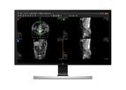 Suitestensa - Version UniViewer - Web Module