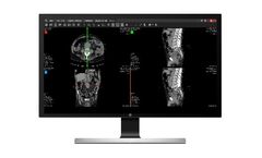 Suitestensa - Version UniViewer - Web Module