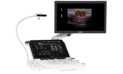 MyLab - Model X90  - Ultrasound Platform for Outstanding Image Quality