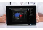 uSmart - Model 3200T NexGen - Touch Screen Ultrasound Scanner