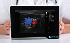 uSmart - Model 3200T NexGen - Touch Screen Ultrasound Scanner