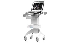 uSmart - Model 3300 NexGen - Ultrasound System