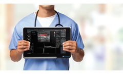 uSmart - Model 3200T Plus - Ultrasound System