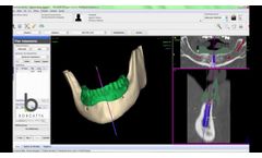 NemoScan Inteligencia Médica - Borgatta - Video