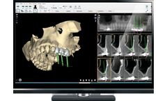 NemoScan - Solution for Diagnosis and Planning of Implantology Treatments