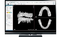 NemoCast - Solution for Diagnosis and Digital Planning of Orthodontic Models