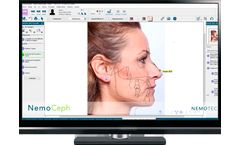 NemoCeph - Cephalometric, VTO and STO 2D Virtual Analysis Software