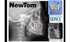 Newtom - CephX - Artificial Intellingence Cephalometry
