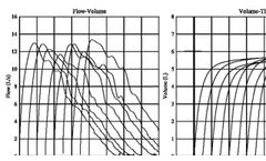 Benson Medical Instruments CCS-200 Spirometer Report Builder - Video