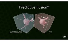 bkFusion: How it Works - Video