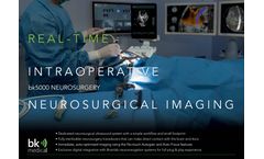 BK-Medical - Model bk5000 - Ultrasound Imaging Machine for Neurosurgical Procedures - Brochure
