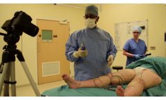 Nouvag LipoSurg - Video