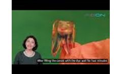 Photoactivated Disinfection PAD Antimicrobial Photodynamic Therapy aPDT in Root Canal Treatment - Video