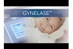 Gynelase: the most complete Gyne Laser Solution - Video