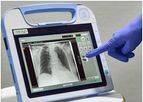 Roesys - Model X Vison go - Digital Radiography System