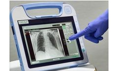 Roesys - Model X Vison go - Digital Radiography System
