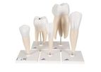 3B Scientific - Model Classic Series - Human Tooth Models Set