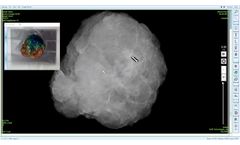 The MOZART System - Revolutionizing Breast Cancer Surgery - Video