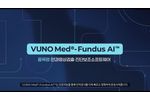 Vuno Med-Fundus AI - Video