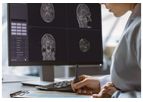 Med-DeepBrain - Supporting Tool for Diagnosis