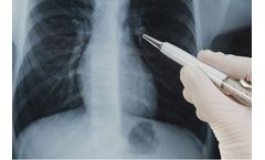 Vuno Med - Chest X-ray Software