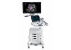 Arietta - Model 50 - Comprehensive Diagnostic Ultrasound System