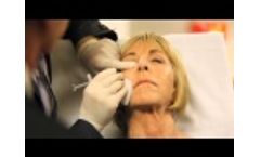 DermaSculpt Microcannula for Injectable Fillers- Bruiseless Fillers - Video