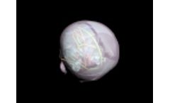 New Born Head (Dynamic) - Video