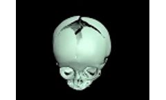 Newborn Skull Phantom Desigin - Video