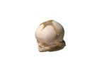 TPS - Newborn Human Skull Phantom