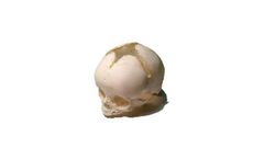 TPS - Newborn Human Skull Phantom