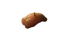 TPS - Newborn Torso for Ultrasound