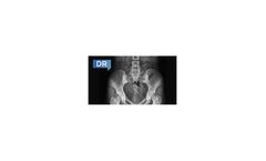 Nexus - Version DR - Advanced Digital Imaging Acquisition System