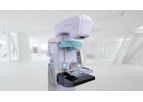 Viola - Model DBT - Advanced and Innovative Breast Tomosynthesis System